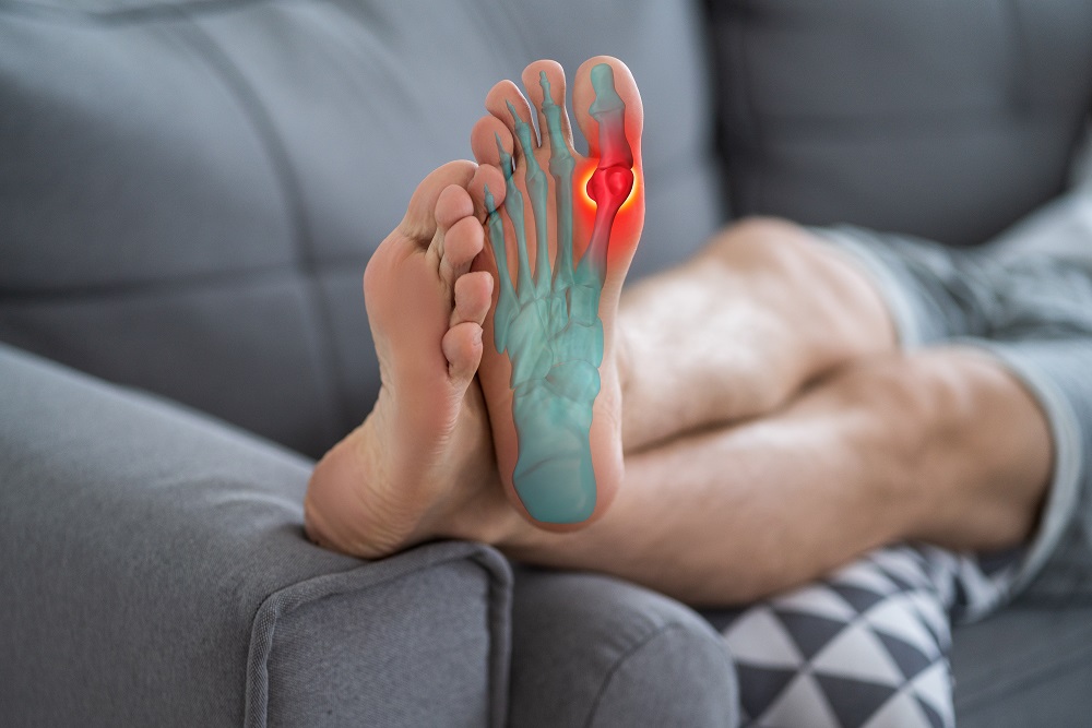 Do you suffer from gout?